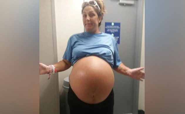 Під час вагітності її живіт досяг величезних розмірів, а коли дитина народилася, були здивовані навіть лікарі!