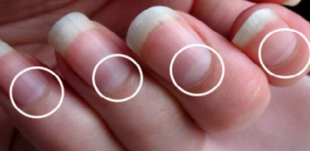 А у вас є “півмісяць” на нігтях? Дізнайтеся, про що це свідчить … цікава інформація