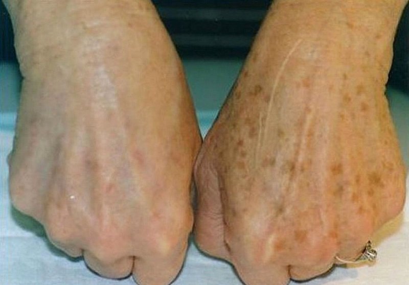 Шипучка для рук, здатна перетворити шкіру після дачного сезону. Одного застосування в тиждень досить!