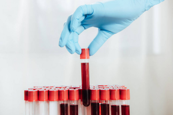 Фахівці назвали групи крові, чиї власники відрізняються особливо сильним імунітетом
