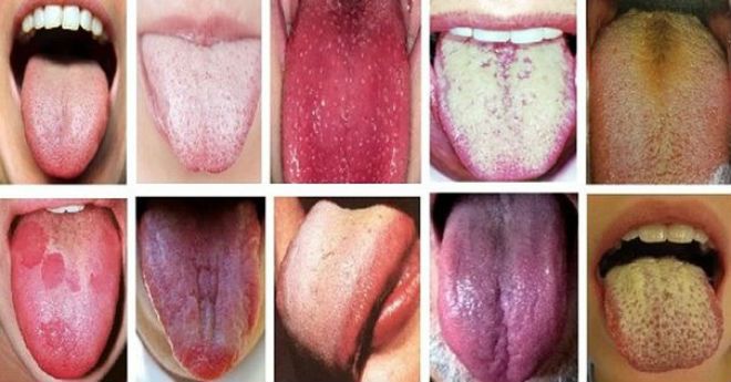 Не всі це знають!Обов’язково перевірте ваш колір язика, він багато що розповість про стан здоров’я…