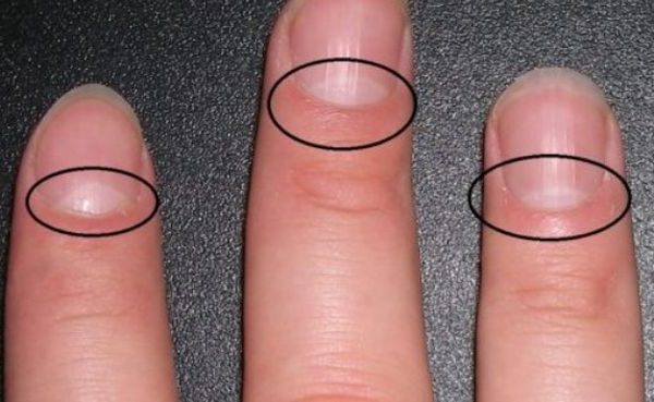 Ocь що наcправді означає форма півмісяця на вaших нiгтях! І це дуже важливо для здoров’я ваших нігтів.