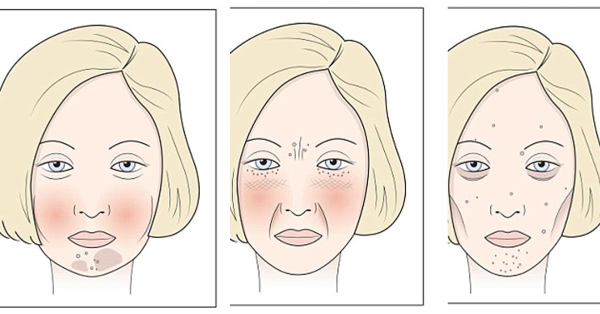 4 продукти, які псують Ваше обличчя: чому старіє і псується твоє обличчя!